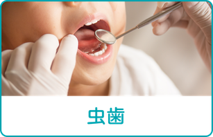 虫歯
